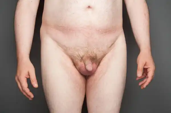 My contribution to the Manhood project